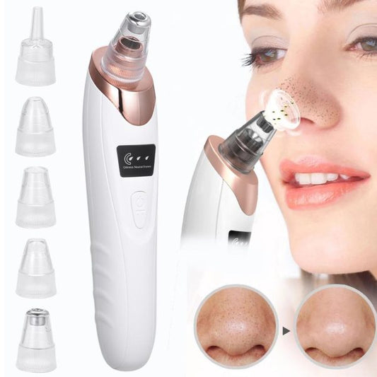 Electric Suction Blackhead Instrument Home Beauty Instrument Blackhead Pore Cleaning
